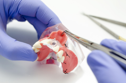 Mouth checkup