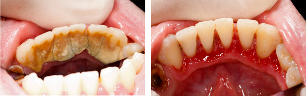 Mouth checkup